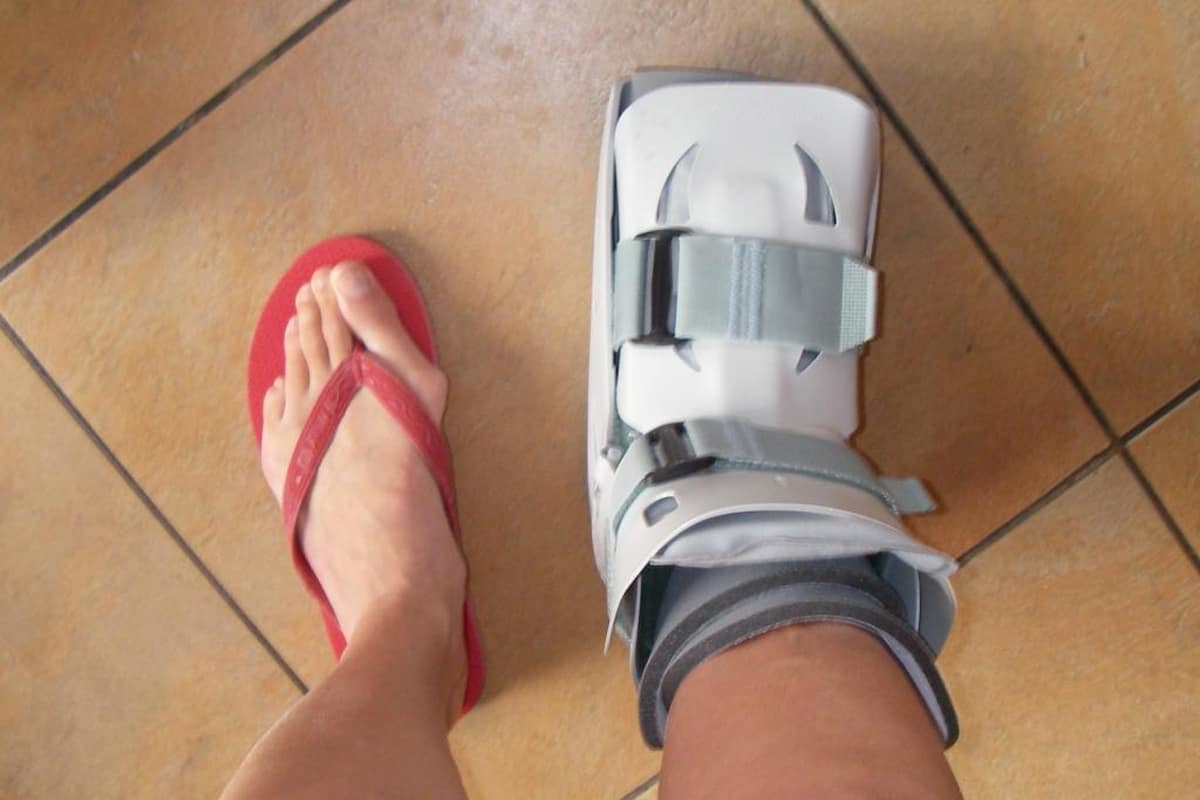 Операция вальгусная реабилитация. Обувь после операции на косточках ног. Сапожок при переломе большого пальца ноги. Обувь для реабилитации после операции на стопе.