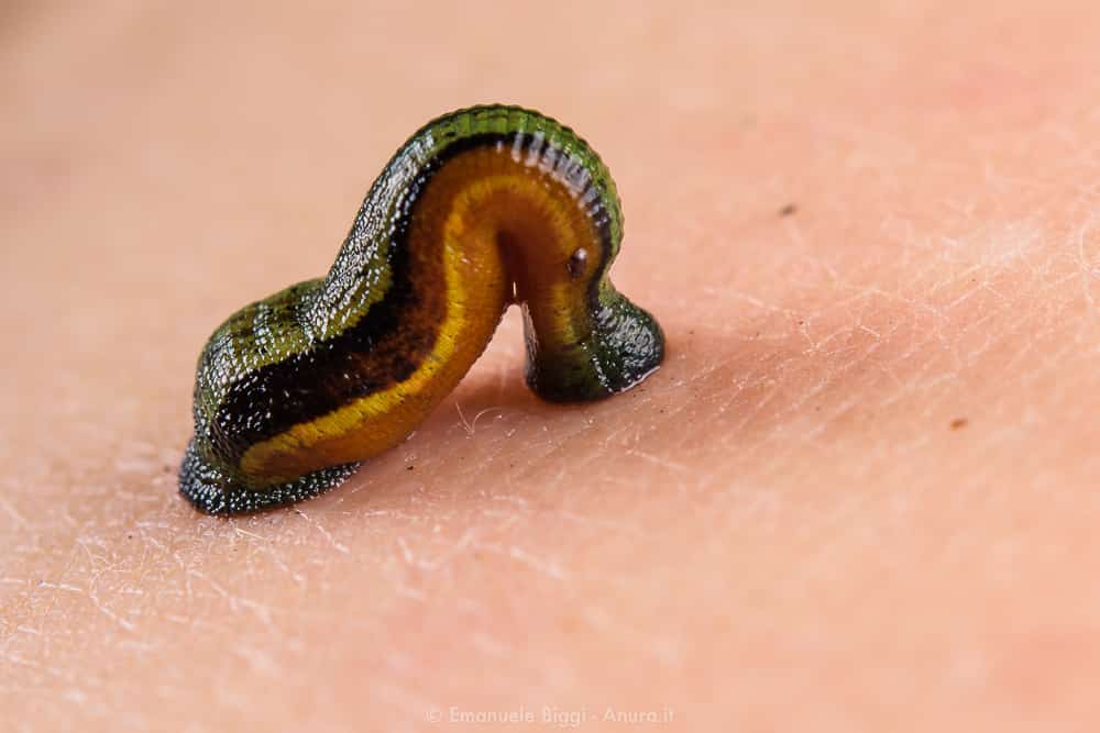 Introducing the types of leech therapy +The purchase price