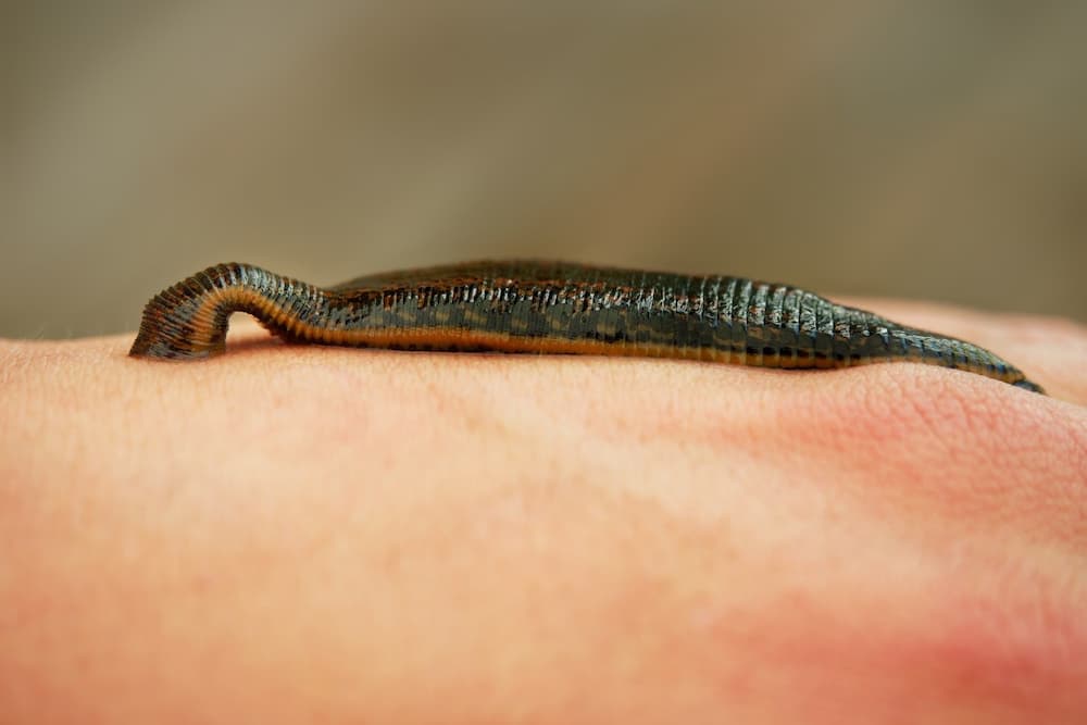 Leech in the Philippines