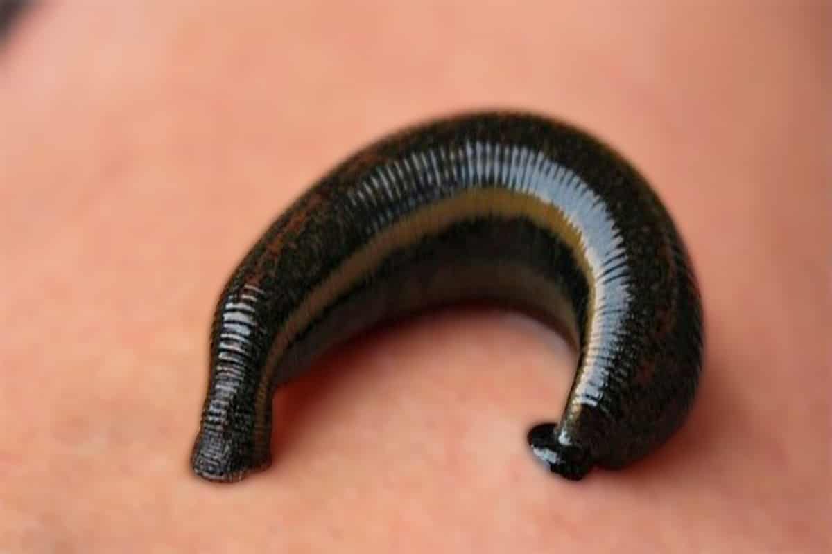 Leech medicinal benefits therapy side effects