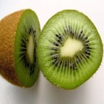 The purchase price of kiwifruit trellis + advantages and disadvantages