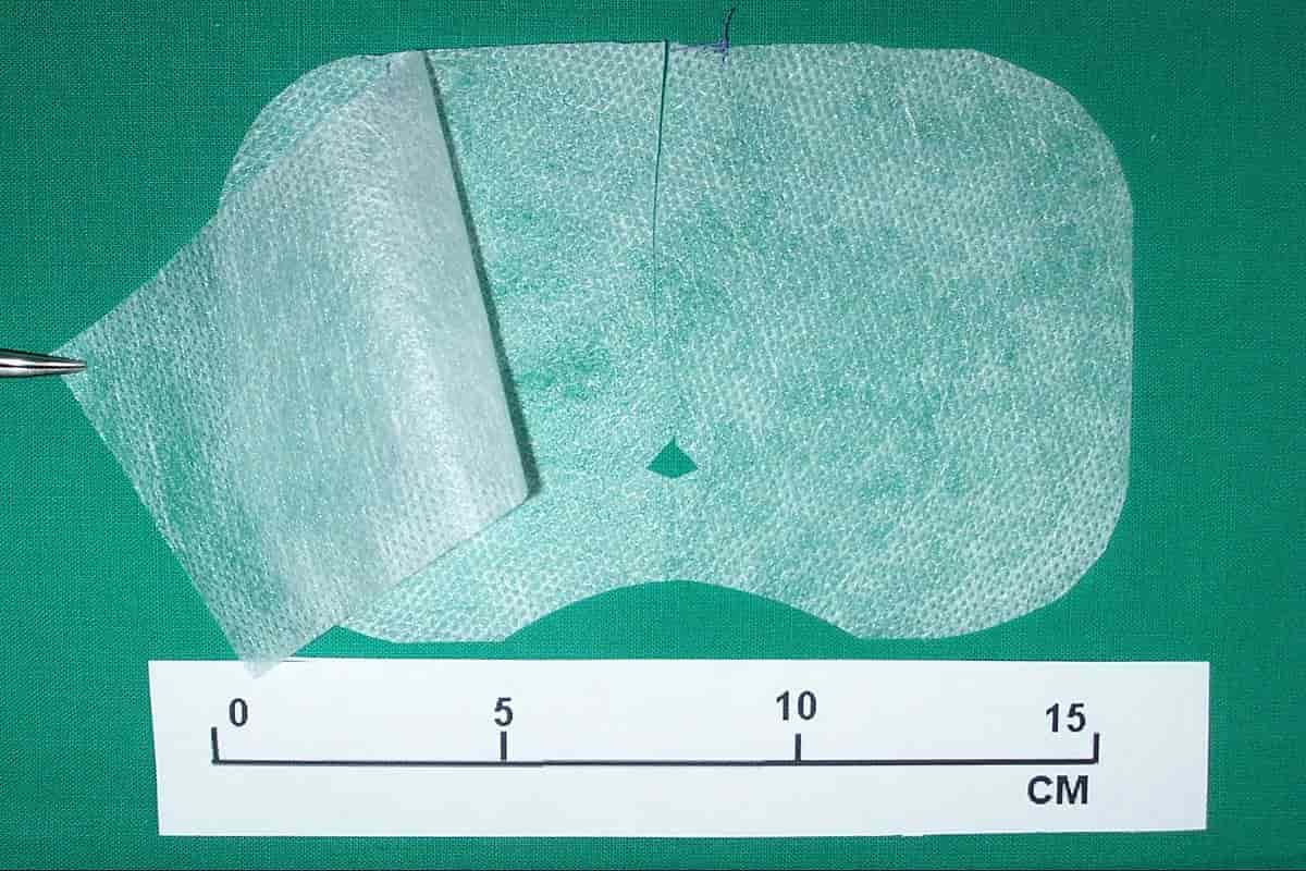 inguinal hernia mesh size