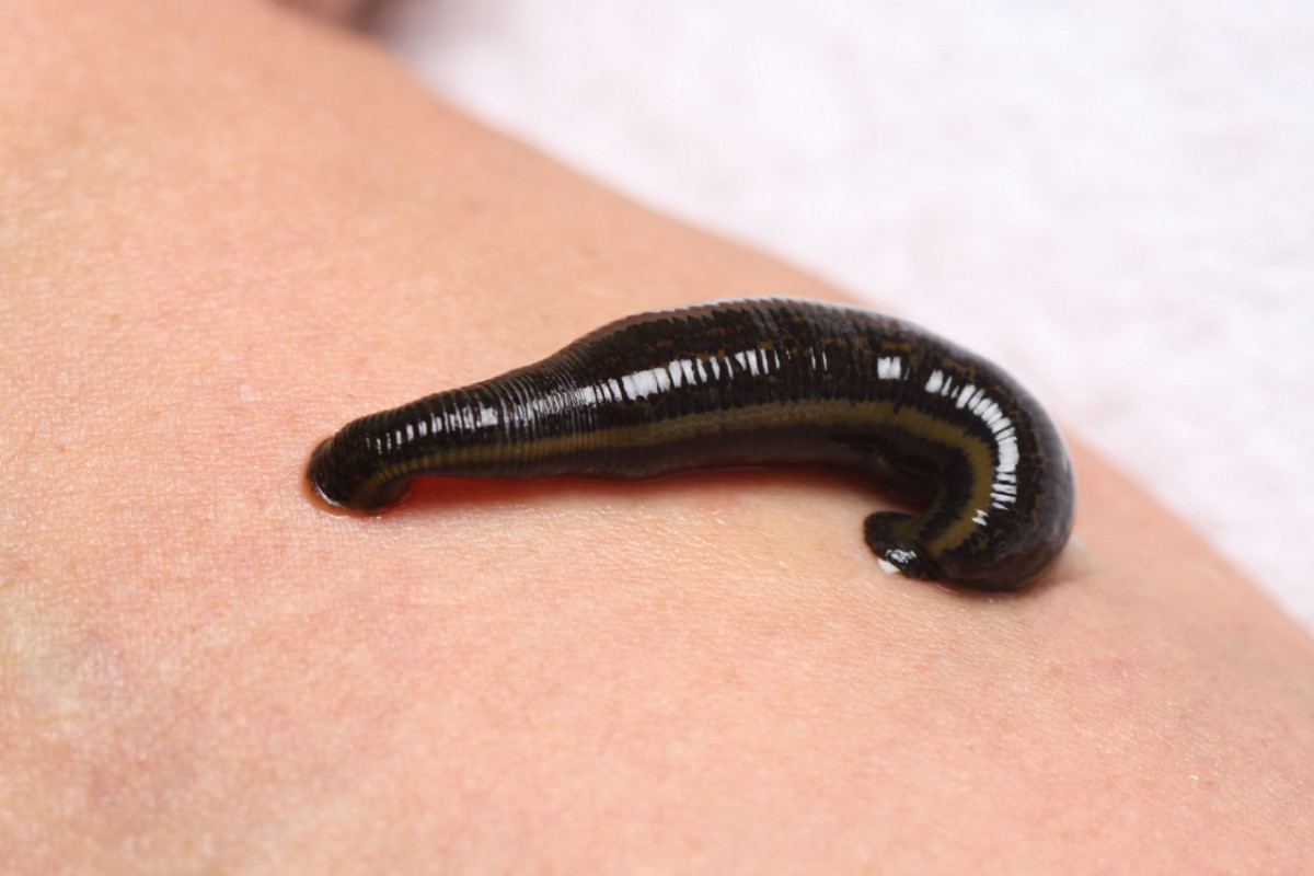 Are leeches dangerous to humans