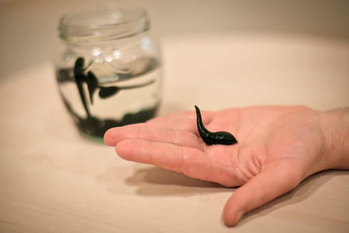 Leech therapy side effects