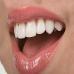نانو سرامیک دندان؛ پرکننده ترمیم کننده مقاوم طبیعی