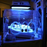 لامپ مهتابی برای زردی نوزاد (فتوتراپی) رنگ آبی بدون ضرر طول عمر بالا