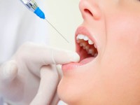 سرسوزن دندانپزشکی ck ject؛ استیل 2 نوع دائمی یکبار مصرف (50 100) عددی