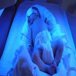 لامپ مهتابی زردی نوزاد (فلورسنت) بی خطر باکیفیت آبی فتوتراپی LED