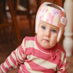 کلاه طبی سر نوزاد | خرید با قیمت ارزان