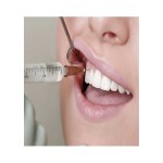 خرید انواع سرسوزن دندانپزشکی گیج 30 + قیمت