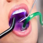 آموزش خرید دستگاه ساکشن دندانپزشکی صفر تا صد