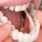 روکش یکبار مصرف دندان همراه با توضیحات کامل و آشنایی