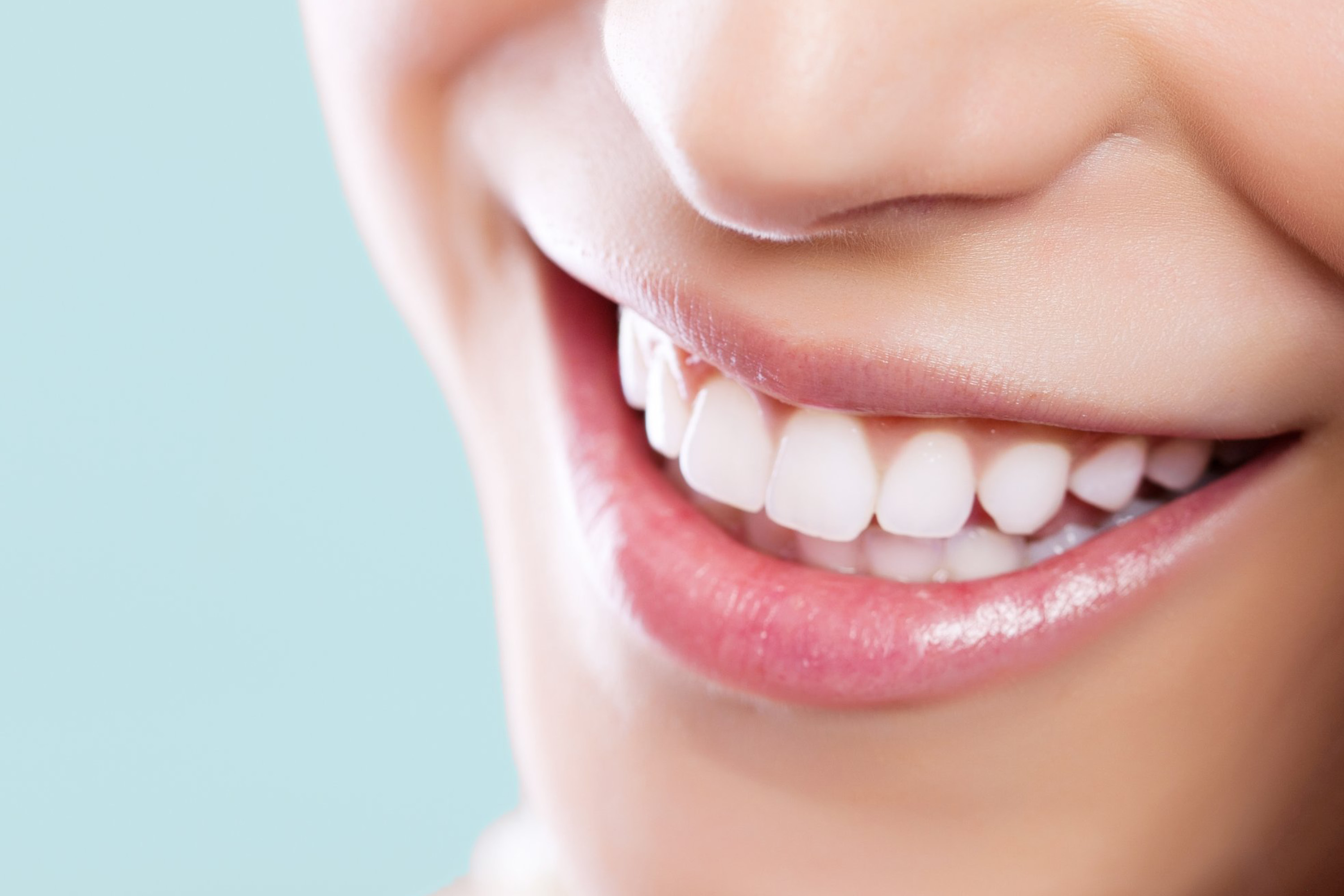 مشخصات سفید کننده دندان سولار