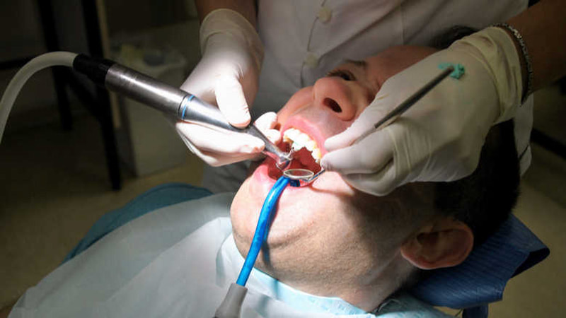 ساکشن دندانپزشکی مرکزی