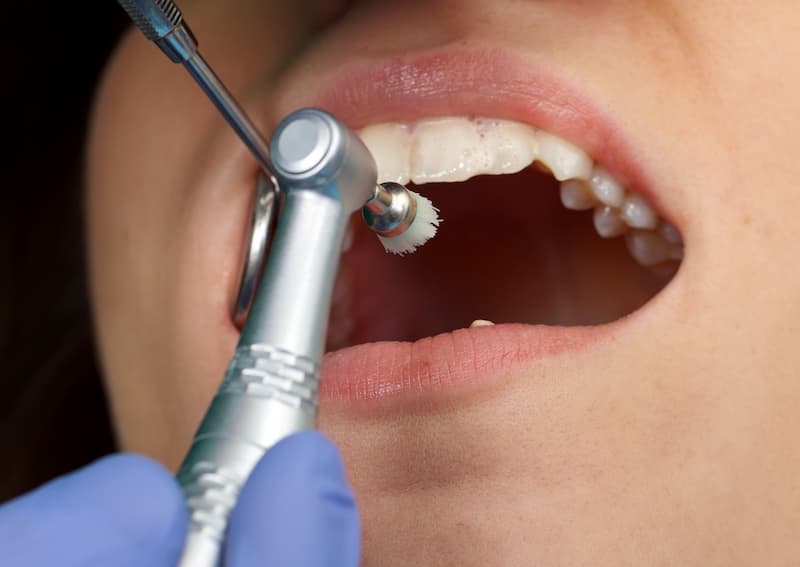دستگاه دندانپزشکی