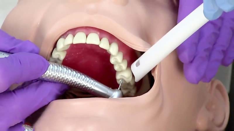ساکشن دندانپزشکی دست دوم