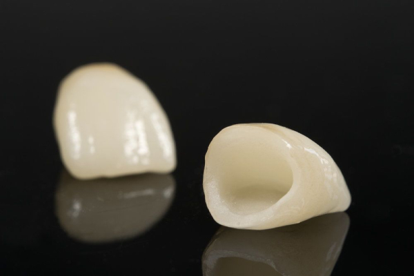لمینت سرامیکی دندان (Dental ceramic laminate) + قیمت خرید عالی